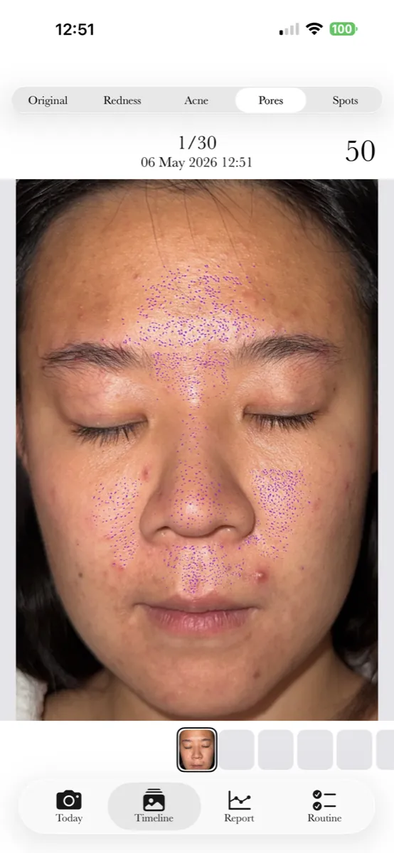 AI pore detection overlay