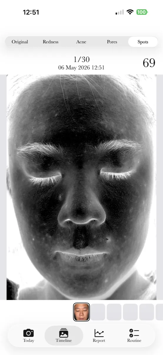 AI dark spot detection in dark mode